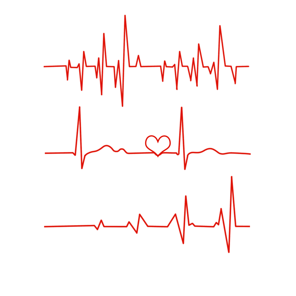 ELETROCARDIOGRAMA